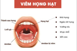 khắc phục đơn giản chấm dứt tình trạng viêm họng hạt