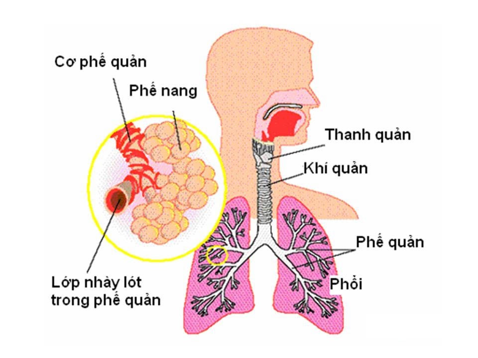 Xem ngay để hiểu rõ về viêm phế quản